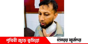 মুরাদনগরের এসিল্যান্ড সাকিব হাসান খাঁনের ওপর ডাকাত হামলা, নিরাপত্তা নিয়ে উদ্বেগ।